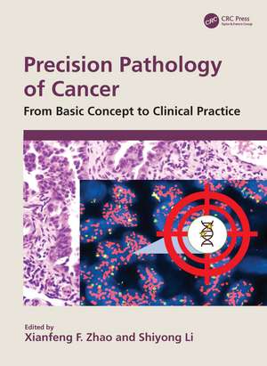 Precision Pathology of Cancer: From Basic Concept to Clinical Practice de Xianfeng F. Zhao