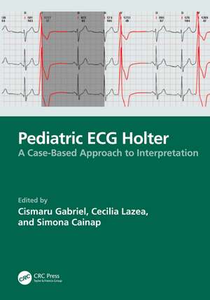 Pediatric ECG Holter de Cismaru Gabriel