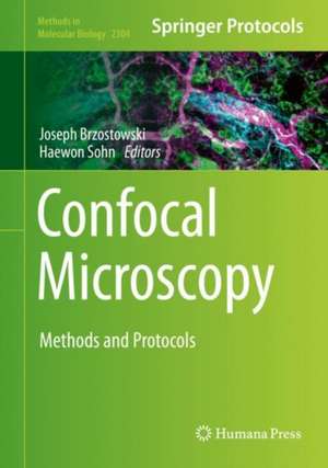 Confocal Microscopy: Methods and Protocols de Joseph Brzostowski