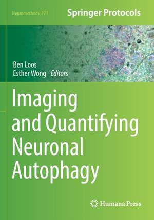 Imaging and Quantifying Neuronal Autophagy de Ben Loos