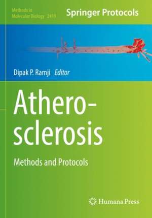 Atherosclerosis: Methods and Protocols de Dipak Ramji