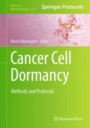 Cancer Cell Dormancy: Methods and Protocols de Marco Montagner