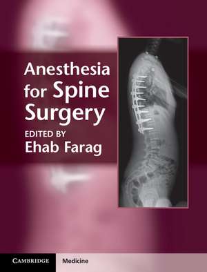 Anesthesia for Spine Surgery de Ehab Farag