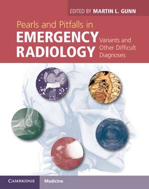 Pearls and Pitfalls in Emergency Radiology: Variants and Other Difficult Diagnoses de Martin L. Gunn