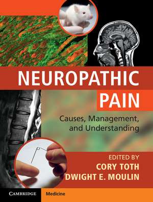 Neuropathic Pain: Causes, Management and Understanding de Cory Toth