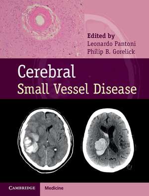 Cerebral Small Vessel Disease de Leonardo Pantoni