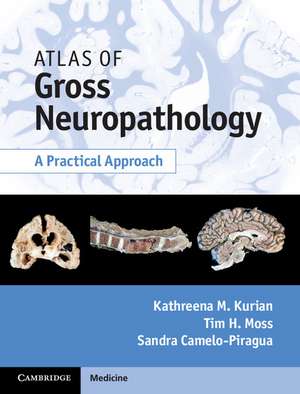 Atlas of Gross Neuropathology Book and Online Bundle: A Practical Approach de Kathreena M. Kurian