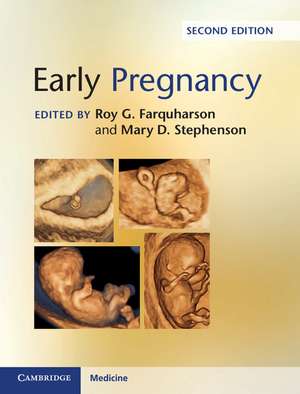 Early Pregnancy de Roy G. Farquharson