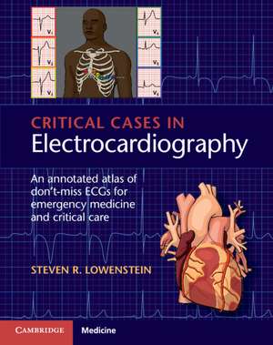 Critical Cases in Electrocardiography: An Annotated Atlas of Don't-Miss ECGs for Emergency Medicine and Critical Care de Steven R. Lowenstein