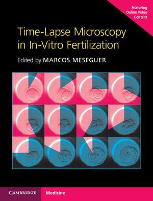 Time-Lapse Microscopy in In-Vitro Fertilization Hardback with Online Resource de Marcos Meseguer