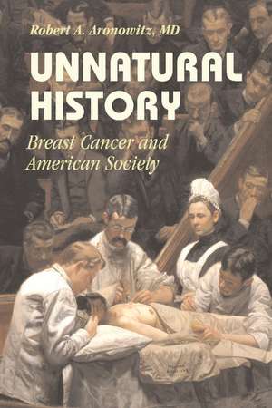 Unnatural History: Breast Cancer and American Society de Robert A. Aronowitz