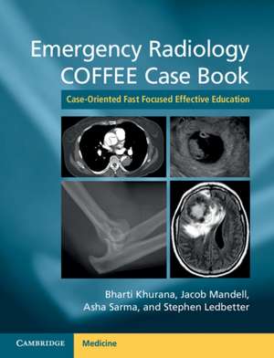 Emergency Radiology COFFEE Case Book: Case-Oriented Fast Focused Effective Education de Bharti Khurana