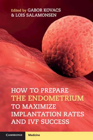 How to Prepare the Endometrium to Maximize Implantation Rates and IVF Success de Gabor Kovacs