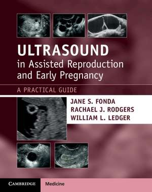 Ultrasound in Assisted Reproduction and Early Pregnancy: A Practical Guide de Jane S. Fonda