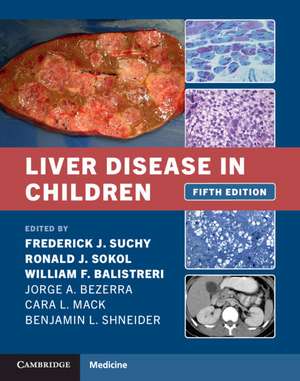 Liver Disease in Children de Frederick J. Suchy