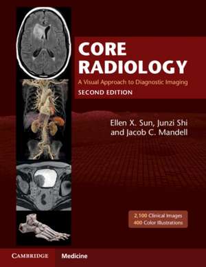 Core Radiology: A Visual Approach to Diagnostic Imaging de Ellen X. Sun