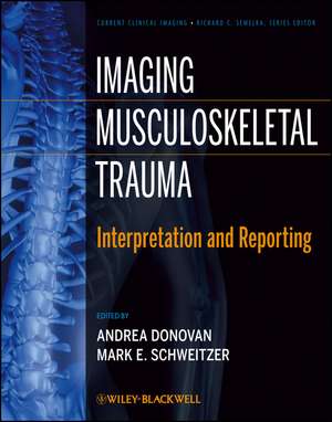 Imaging Musculoskeletal Trauma – Interpretation and Reporting de A Donovan