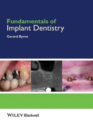 Fundamentals of Implant Dentistry de Gerard Byrne