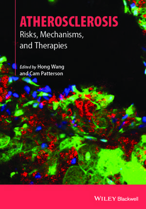 Atherosclerosis – Risks, Mechanisms and Therapies de Hwang