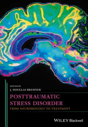 Posttraumatic Stress Disorder – From Neurobiology to Treatment de JG Bremner