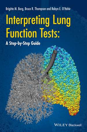 Interpreting Lung Function Tests – A Step–by–Step Guide de BM Borg