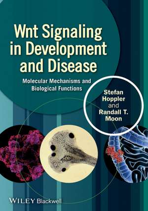 Wnt Signaling in Development and Disease – Molecular Mechanisms and Biological Functions de SP Hoppler