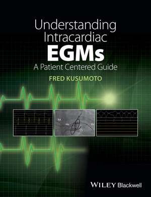 Understanding Intracardiac EGMs – A Patient Centered Guide de F Kusumoto