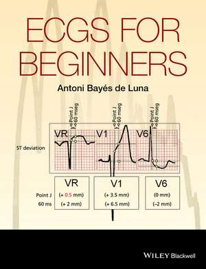 Ecgs for Beginners