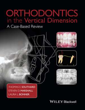 Orthodontics in the Vertical Dimension – A Case–Based Review de TE Southard