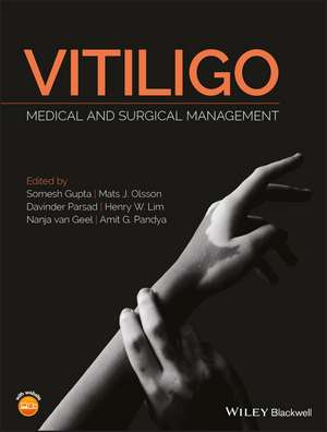 Vitiligo – Medical and Surgical Management de S. Gupta