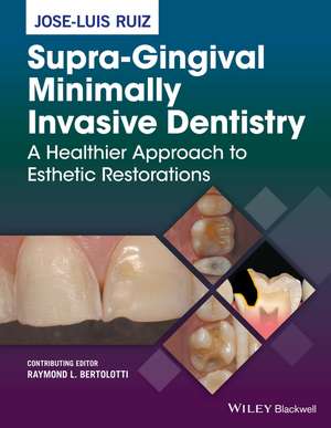 Supra–Gingival Minimally Invasive Dentistry – A Healthier Approach to Esthetic Restorations de JL Ruiz