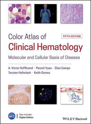 Color Atlas of Clinical Hematology – Molecular and Cellular Basis of Disease de AV Hoffbrand