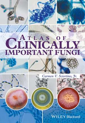 Atlas of Clinically Important Fungi de CV Sciortino