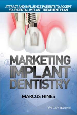 Marketing Implant Dentistry – Attract and Influence Patients to Accept Your Dental Implant Treatment Plan de M Hines