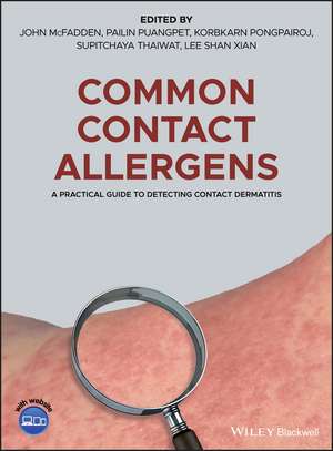 Common Contact Allergens – A Practical Guide to Detecting Contact Dermatitis de J McFadden