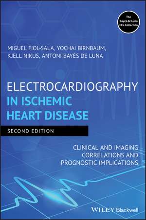 Electrocardiography in Ischemic Heart Disease: Clinical and Imaging Correlations and Prognostic Implications de Miguel Fiol-Sala