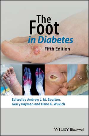 The Foot in Diabetes 5th Edition de AJM Boulton