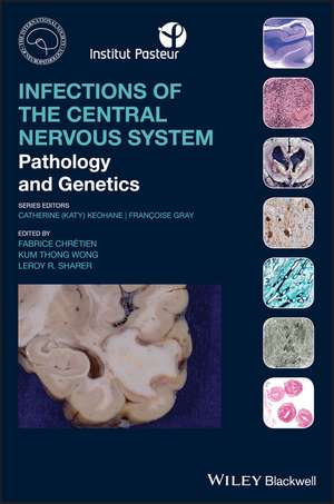 Infections of the Central Nervous System – Pathology and Genetics de F Chretien