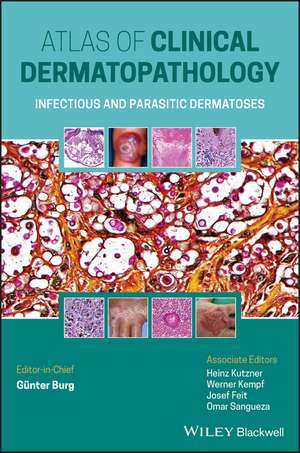 Atlas of Clinical Dermatopathology – Infectious and Parasitic Dermatoses de G Burg