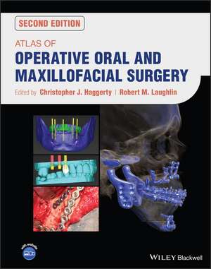 Atlas of Operative Oral and Maxillofacial Surgery de CJ Haggerty