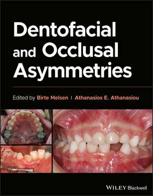 Dentofacial and Occlusal Asymmetries de Birte Melsen