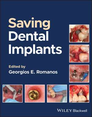 Saving Dental Implants de Romanos