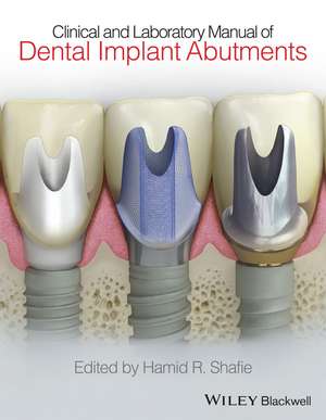 Clinical and Laboratory Manual of Dental Implant Abutments de HR Shafie