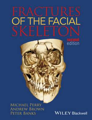 Fractures of the Facial Skeleton 2e de AK Perry