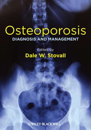 Osteoporosis – Diagnosis and Management de D Stovall