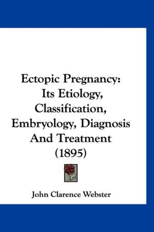 Ectopic Pregnancy de John Clarence Webster