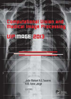 Computational Vision and Medical Image Processing IV: VIPIMAGE 2013 de Joao Manuel RS Tavares