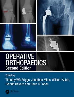 Operative Orthopaedics de Timothy WR Briggs