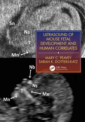 Ultrasound of Mouse Fetal Development and Human Correlates de Mary C. Peavey