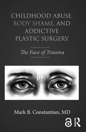 Childhood Abuse, Body Shame, and Addictive Plastic Surgery: The Face of Trauma de Mark B. Constantian